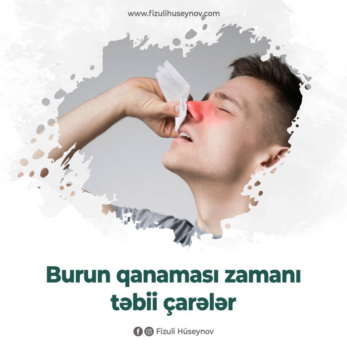 BURUN QANAMASI ZAMANI TƏBİİ ÇARƏLƏR.